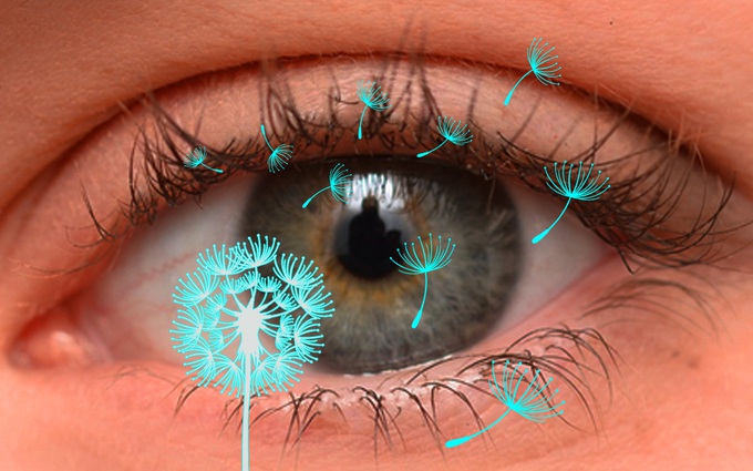 Viêm kết mạc dị ứng là gì? (Đau mắt đỏ dị ứng là gì) và những điều cần biết về bệnh