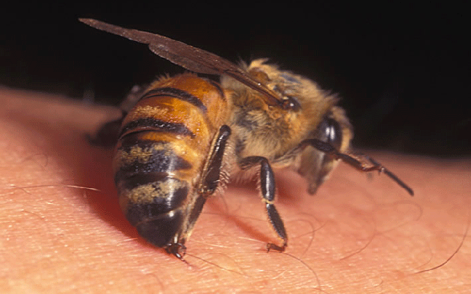 Nhiều người bị ong đốt gây sốc phản vệ nguy hiểm, cần làm gì khi bị ong đốt?