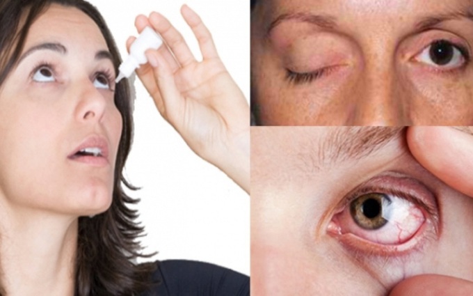 Chớ khinh suất khi bị đau nhức mắt, nguyên nhân và cách điều trị đau mắt