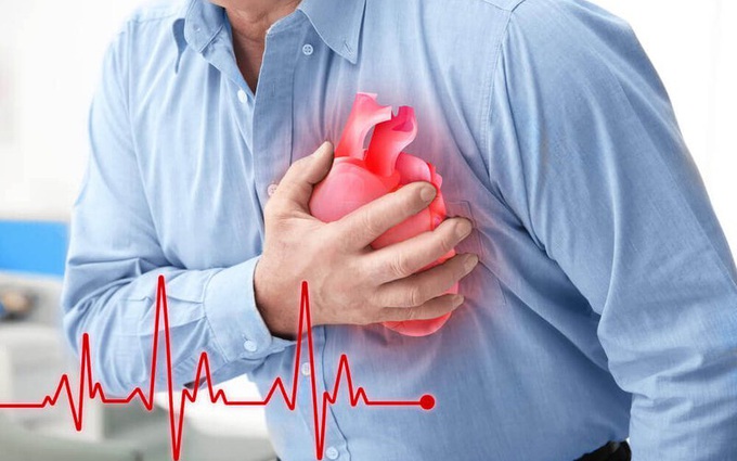 Khuyến cáo đối với bệnh nhân bị tim mạch trong mùa dịch COVID-19