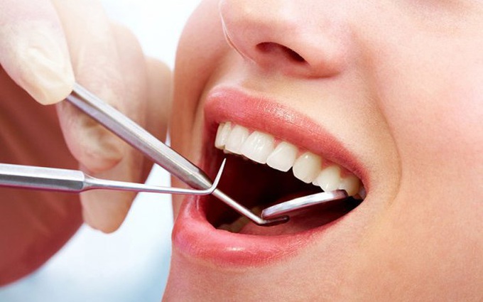 Lấy cao răng có ảnh hưởng đến sức khỏe không? Nên lấy cao răng mấy lần trong năm?