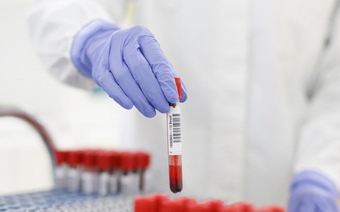 Bộ Y tế: Không sử dụng xét nghiệm kháng thể SARS-CoV-2 sai mục đích