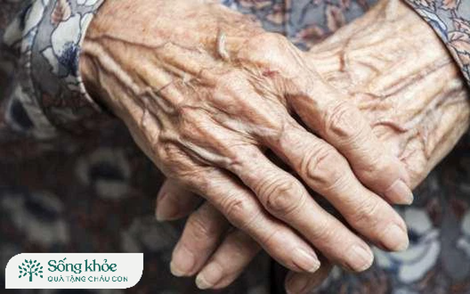 Suy dinh dưỡng ở người cao tuổi có ảnh hưởng tới tính mạng không? Làm cách nào để nhận biết?