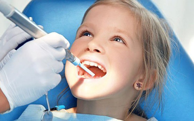 Sâu răng ở trẻ em là gì? Điều trị sâu răng ở trẻ em bằng cách nào?