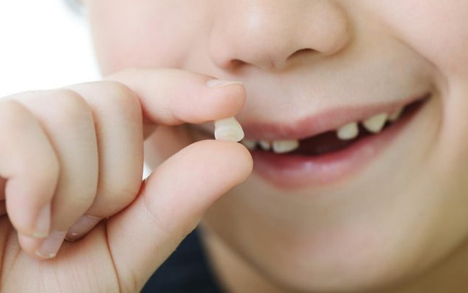 Tự nhổ răng sữa tại nhà, răng bé gái 8 tuổi bị rơi vào phổi dẫn tới viêm phổi nặng