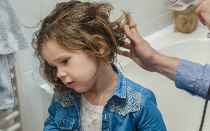 Trẻ em bị rụng tóc do bệnh lý, xử lý bằng cách nào?