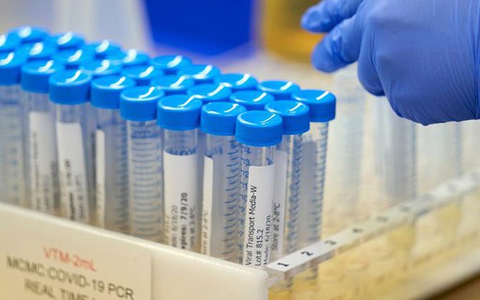 Biến thể COVID mới tại Pháp có thể 'qua mặt' xét nghiệm PCR