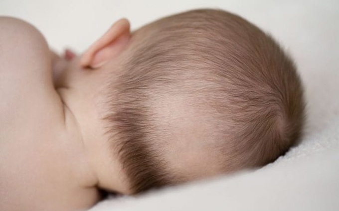 Vị trí rụng tóc ở trẻ sơ sinh và nguyên nhân nào gây rụng tóc ở trẻ?