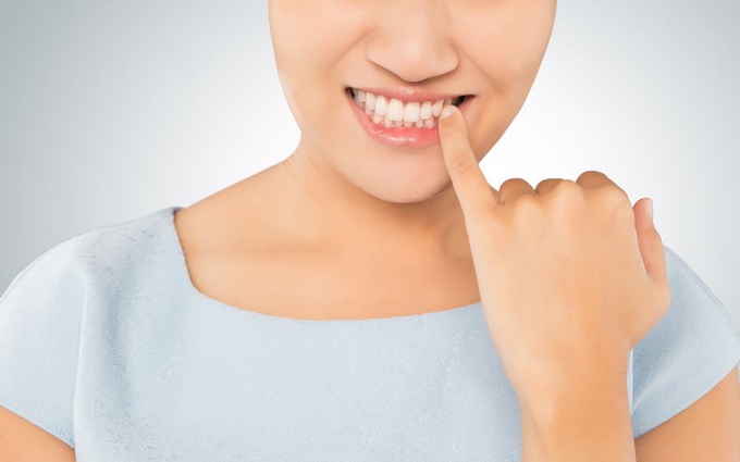 Ngứa nướu răng là gì? Những điều cần biết khi bị ngứa chân răng