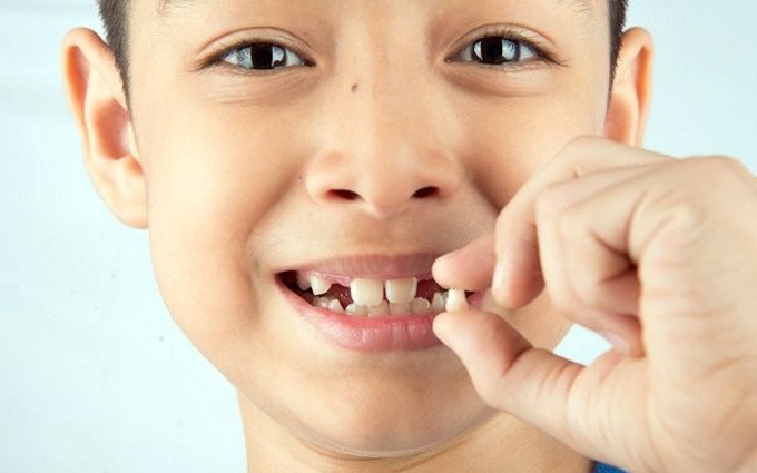 Những răng nào sẽ thay ở trẻ em? Răng sữa không thay có sao không?