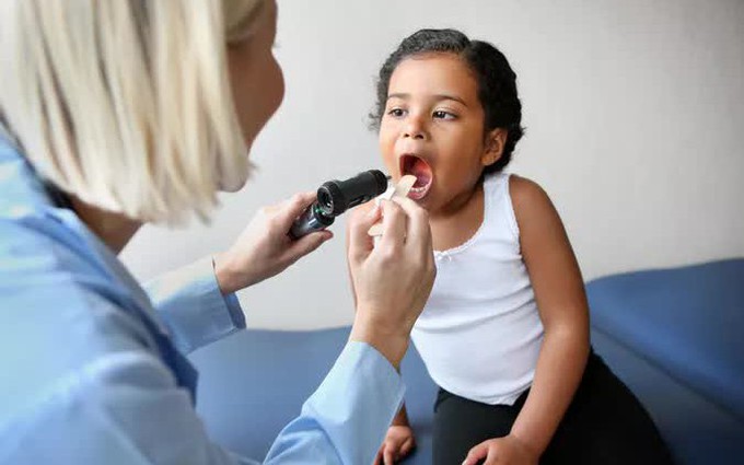 Chuyên gia hướng dẫn cách đối phó với đau họng ở trẻ