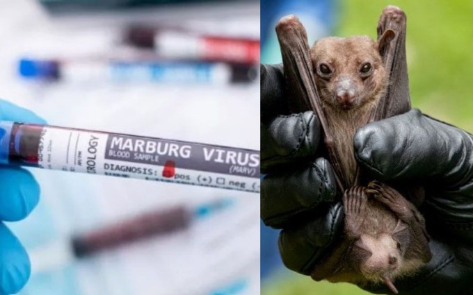 Virus Marburg: loại virus khiến WHO tuyên bố cảnh báo đợt bùng phát loại virus mới là gì?