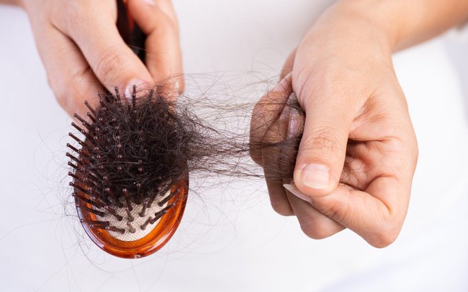 5 mẹo cải thiện tình trạng rụng tóc hậu Covid-19