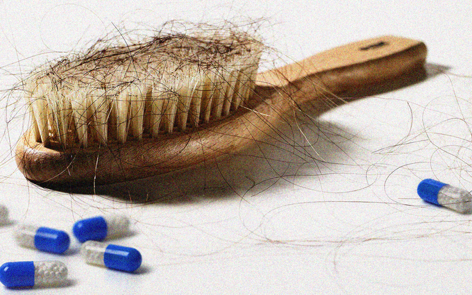 Bổ sung Biotin có giúp kiểm soát rụng tóc hậu COVID-19?