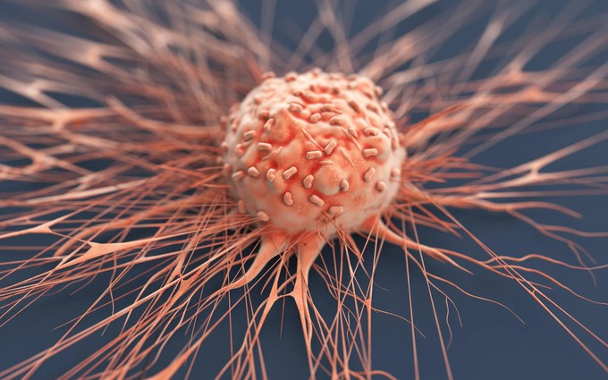 Cảnh báo: 6 chứng viêm nhiễm có thể phát triển thành ung thư nếu không điều trị và kiểm soát sớm