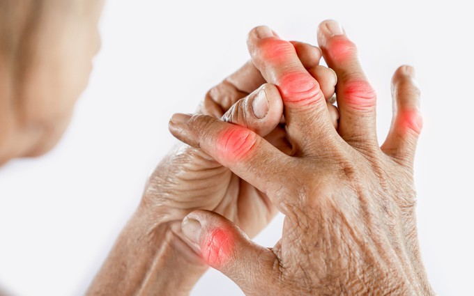 6 cách giảm đau tay do viêm khớp dạng thấp khi giao mùa