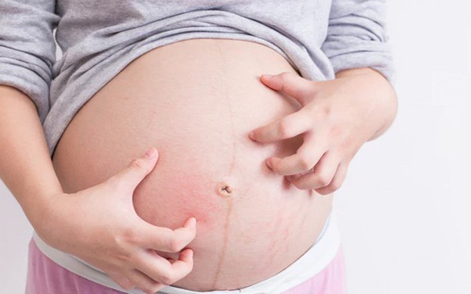 Các tác động tới thai nhi và dấu hiệu nhận biết khi mẹ bị sốt xuất huyết