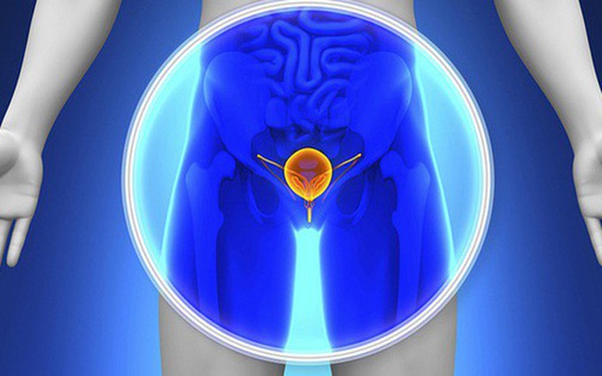 Bệnh ung thư tuyến tiền liệt: dấu hiệu, nguyên nhân, điều trị và cách phòng ngừa
