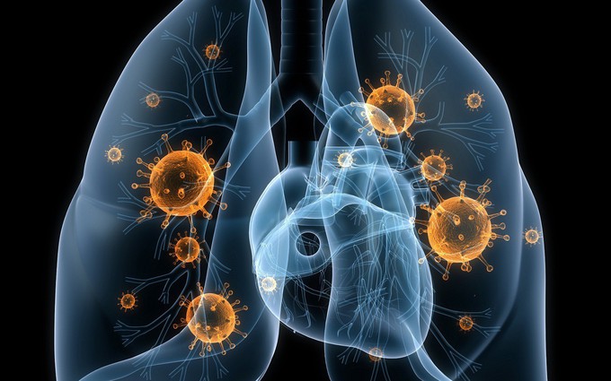10 bài thuốc dân gian phòng và điều trị viêm phổi cực hiệu quả