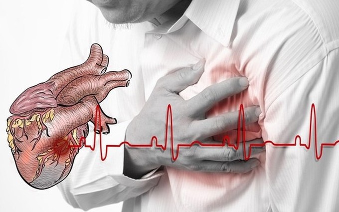 Triệu chứng suy tim và phương pháp cứu nguy cho người bệnh
