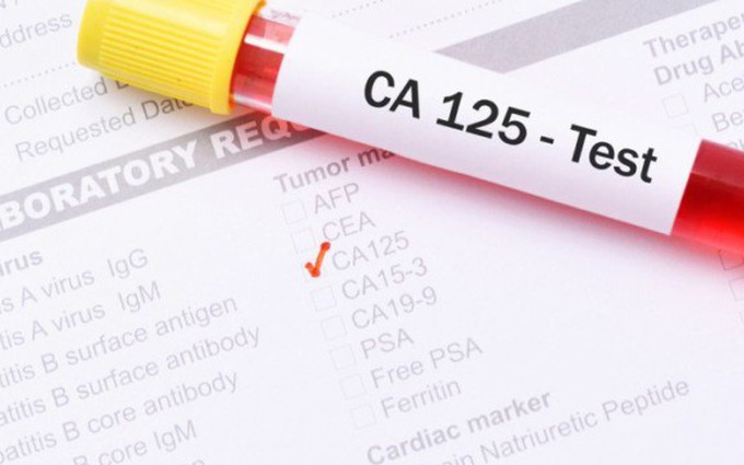 CA 125: Chỉ dấu quan trọng trong tầm soát ung thư buồng trứng