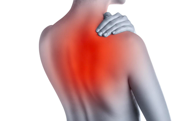 Phân biệt đau lưng thông thường và đau lưng là dấu hiệu của ung thư phổi
