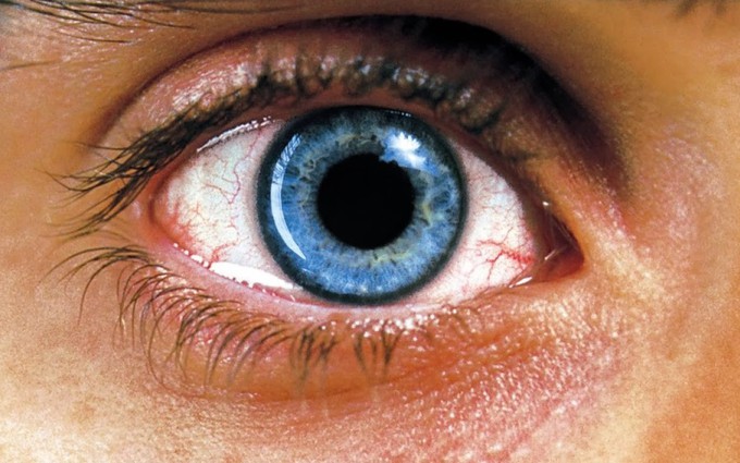 6 nguyên nhân gây ung thư mắt, nguyên nhân thứ 5 vô cùng nguy hiểm