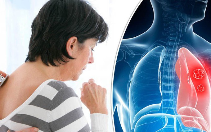 Các bệnh về phổi thường gặp ở phụ nữ