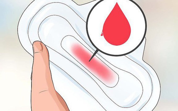 Làm thế nào để phân biệt xuất huyết âm đạo với kinh nguyệt?