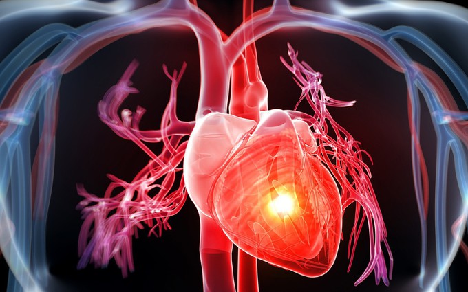 Triệu chứng của bệnh u trong tim có thể bạn chưa biết