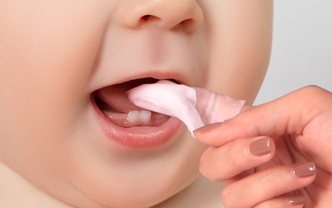 Bố mẹ đã hiểu đúng về bệnh tưa lưỡi ở trẻ chưa?
