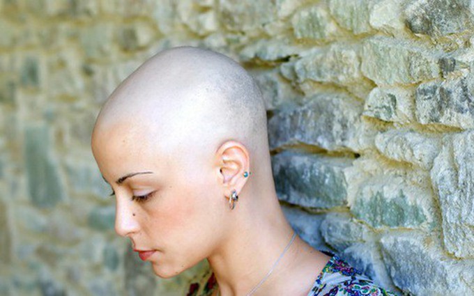 Điều trị ung thư rụng tóc do đâu? Sau bao lâu thì mọc lại?