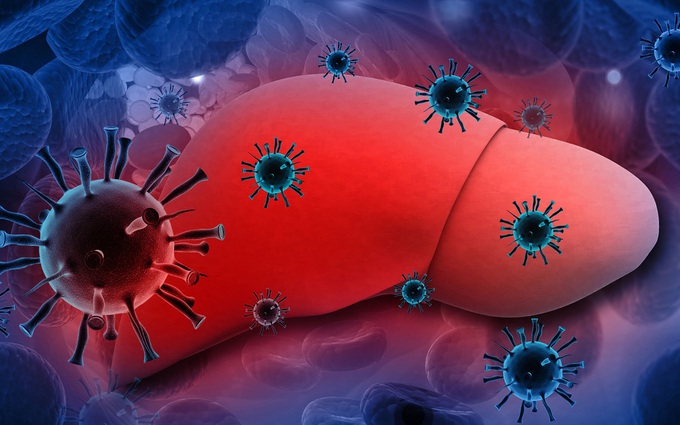 Virus viêm gan B có thể tiến triển thành bệnh xơ gan nếu không phát hiện sớm