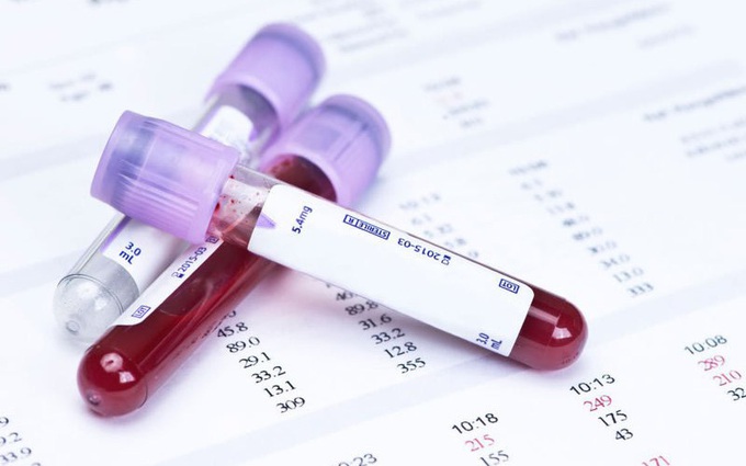 Hướng dẫn cách đọc kết quả xét nghiệm máu: Chỉ số nào giúp phát hiện ung thư, HIV?