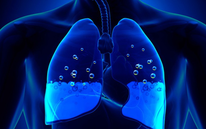 Từ A- Z về bệnh phù phổi