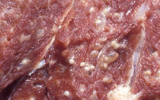 Thịt lợn nhiễm sán nguy hiểm đến mức nào?