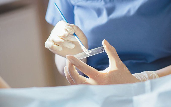 Xét nghiệm Pap smear có tầm soát ung thư cổ tử cung chính xác hay không? 