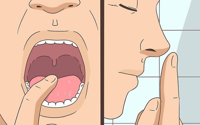 Tìm hiểu nguyên nhân, triệu chứng của bệnh viêm họng đỏ