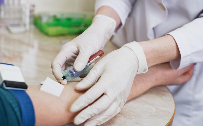 Tìm hiểu về các phương pháp xét nghiệm sốt xuất huyết: gồm những gì và khi nào cần?