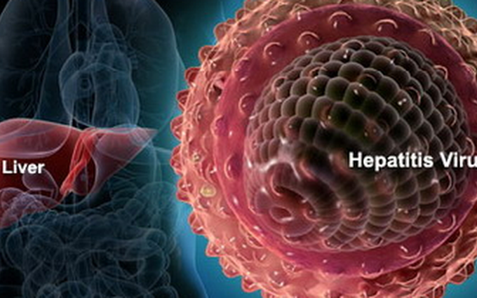 Viêm gan B có thể biến chứng thành xơ gan và ung thư gan: Tỷ lệ nhiễm và quá trình tiến triển