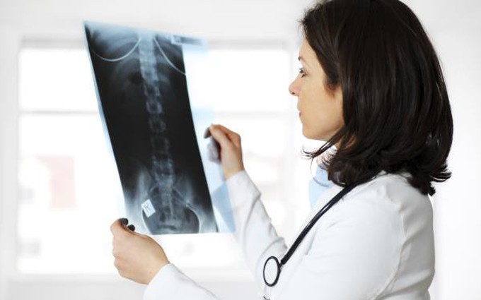 Những điều cần biết về chụp X-quang xương trong dự phòng loãng xương