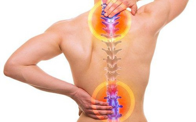 Nhận biết dấu hiệu đau lưng do thoái hóa cột sống
