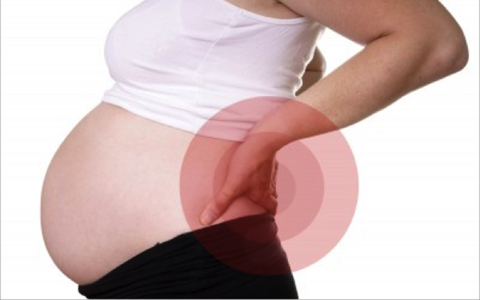 Đau lưng khi mang thai do nguyên nhân gì?