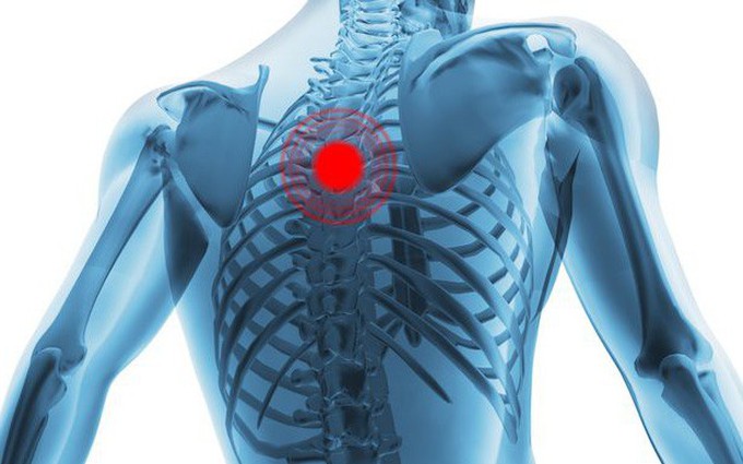 Tìm hiểu về cơn đau lưng trên