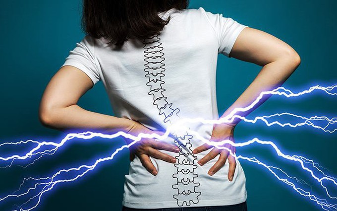 Kiểm soát tốt các cơn đau lưng cấp tính nhờ nắm rõ dấu hiệu bệnh