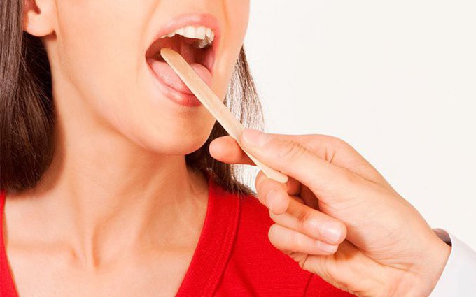 Ung thư lưỡi có chữa được không? Tìm hiểu về khả năng lây nhiễm của ung thư lưỡi