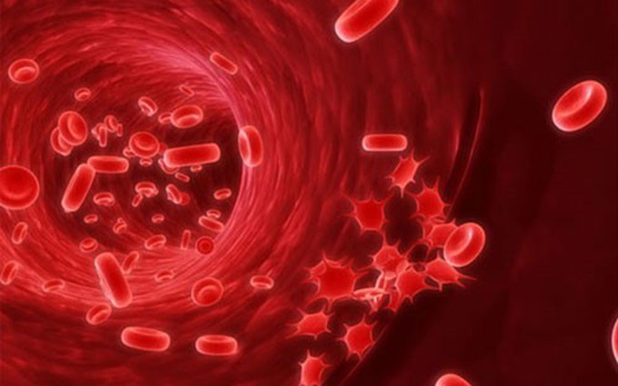 Những bệnh lý nào có khả năng làm tăng nguy cơ bị ung thư máu?