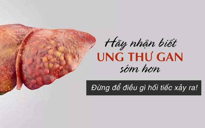 "Thủ phạm" khiến ung thư gan ở Việt Nam tăng cao