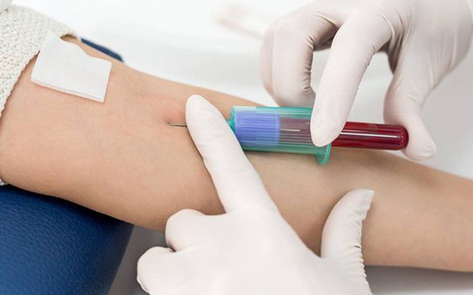 Những xét nghiệm máu nào được sử dụng để chẩn đoán ung thư máu?