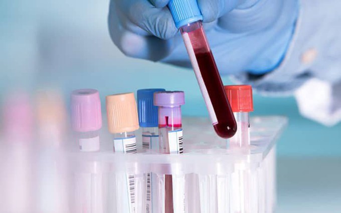 Các xét nghiệm được sử dụng để theo dõi sau điều trị ung thư máu